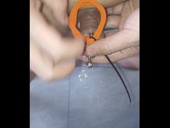 尿道  插管 漏尿 喷尿 出管