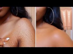stretchmark therapy cream