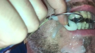 Piss and cum facial on my huge vanbeek braces