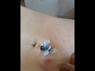 Removing Dried Wax from Deep Navel