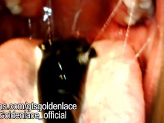 Gummy vore with endo cam