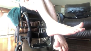 Pasty witte gevoelloze benen van een paraplegische 