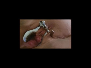 BBW Pussy Stretched by Speculum and Overflowing with Squirting