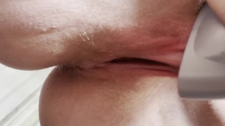 Swelled up clit after seven minutes of vacuum cleaner fun