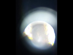 Weed hair through a microscope