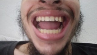 Mis dientes