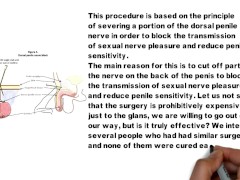 Premature Ejaculation Treatment Tutorial 1-4