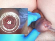 Preview 1 of I put an endoscope in a 10mm test tube and observed the inside of the urethra.