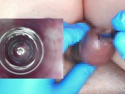 Preview 2 of I put an endoscope in a 10mm test tube and observed the inside of the urethra.