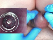 Preview 3 of I put an endoscope in a 10mm test tube and observed the inside of the urethra.