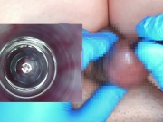 Preview 4 of I put an endoscope in a 10mm test tube and observed the inside of the urethra.