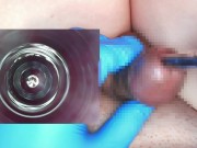 Preview 5 of I put an endoscope in a 10mm test tube and observed the inside of the urethra.