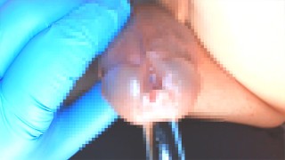 Take a video of putting a glass rod in the urethra.