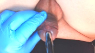 A video shoot of a 10mm metal probe inserted into the urethra from a subjective point of view.