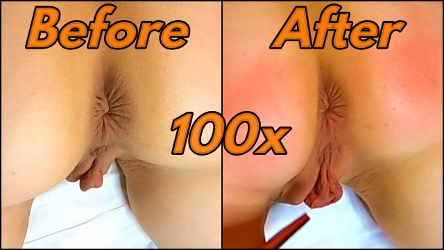 Watch Bondage Video:Enormous Pussy Swelling during long Spanking Session (100 Hits on Perfect Ass)