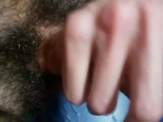 Hairy Cripple Circumcised Dick Getting Speed Handjob