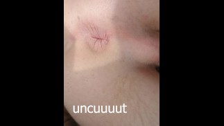 Twink Perineum sonnt Arschloch, während Nachbarn sehen können