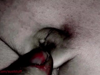 NAVEL VORE