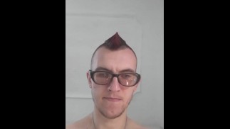 Moja guza