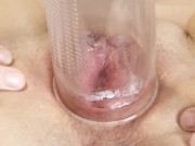 Preview 6 of Pussy & Cervix Play Compilation with Creampie & Pissing Ending
