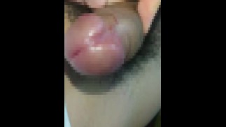 チンカスだらけのチンポがこちらｗｗｗｗSmegma penis!