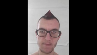My tumor 