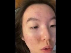 acne peel :)