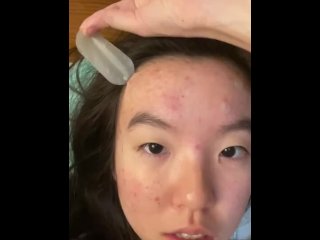 asian, skincare, acne, vertical video