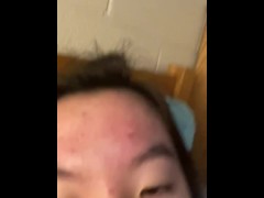 popping pimple :)