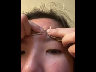 acne, japanese, fetish, vertical video