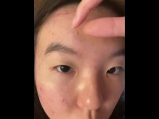 teen, solo female, pimple, vertical video