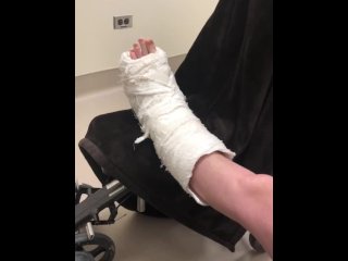 broken leg, behind the scenes, leg boot, exclusive
