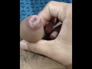 Preview 1 of Applyime medicine my syphilis (sexual transmitted disease) penis. Getting more swallon on my dick he