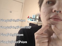 PREVIEW Zit Popping Clip 3