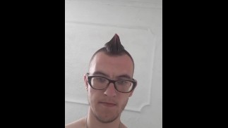 Moja guza 