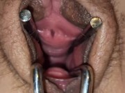 Preview 2 of Pussy expander 🤩 and anal beads in peehole 😳😳😳