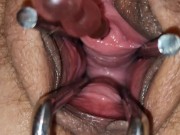 Preview 6 of Pussy expander 🤩 and anal beads in peehole 😳😳😳