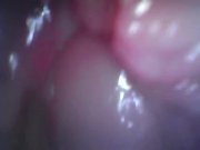 Preview 6 of Endoscope inside pussy - fingering Gspot massage till orgasm