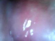Preview 5 of Endoscope inside pussy - Close up fucking with creampie