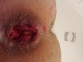 Anal gape close up