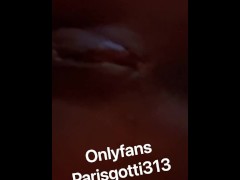 Ts paris Showing her New Vagina “ it’s not healed all the way but baby