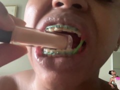 Braces & Lips 1