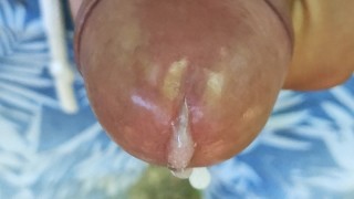 Close-Up Of Cumming Out Of Glans