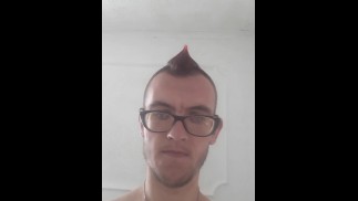 Moja guza