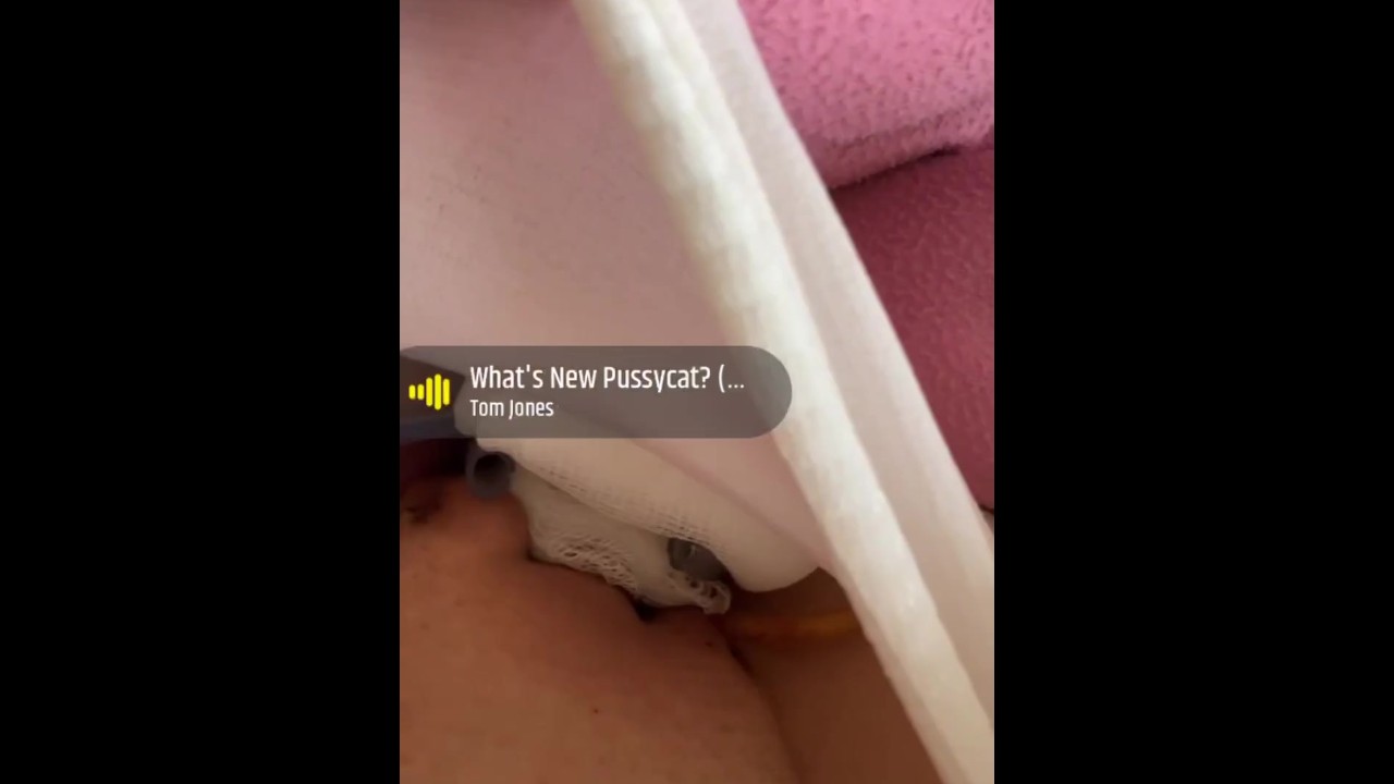 Srs Surgery - Pornhub.com