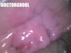 JOURNEY INSIDE WET PUSSY: Doctor Endoscope Video Inspecting Creamy Vagina