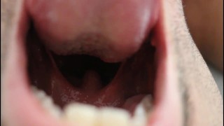 Epische mannelijke mond plagen