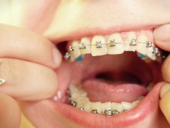 Eating in braces - food fetish - vore video - mouth tour