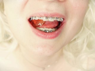 BRACES ASMR video: jelly candy FOOD FETISH with sounds close up