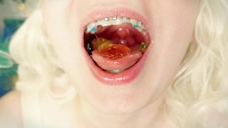 BRACES ASMR Video Jelly Candy FOOD FETISH With Close Up Sounds
